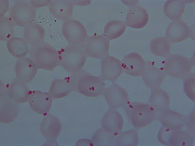 المكورات  السحائية   Neisseria meningitides