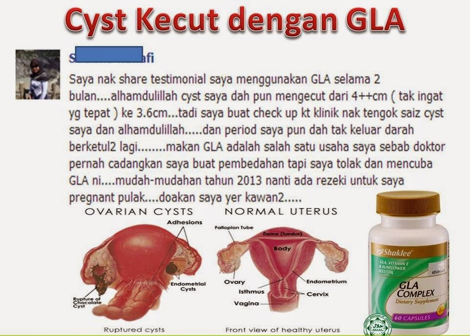 ubat untuk cyst