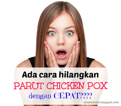 Ubat Nak Hilangkan Parut Chicken Pox - Sinter B