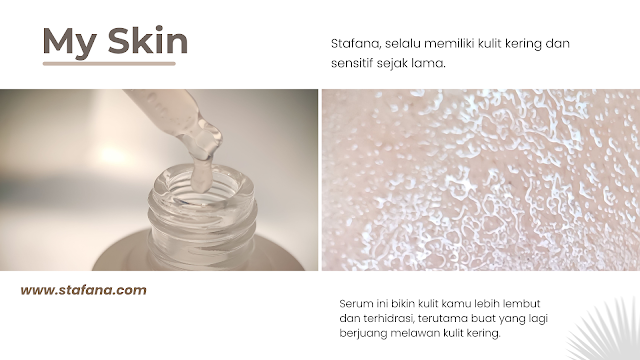 https://www.stafana.com/2023/10/Unlock-Your-Skins-Radiance-with-YOU-serum.html