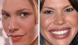 Plastic Surgery