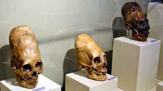 DNA Analysis of the Paracas Skulls Proves They Are Not Human