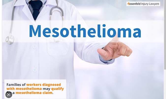 Pleural Mesothelioma - Mesothelioma Lung Cancer