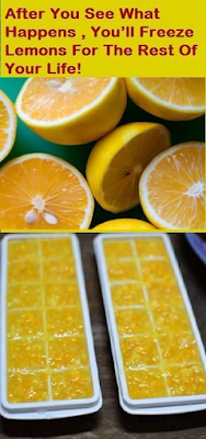 Believe It or Not, Use Frozen Lemons and Say Goodbye to Diabetes, Tumors, Obesity!