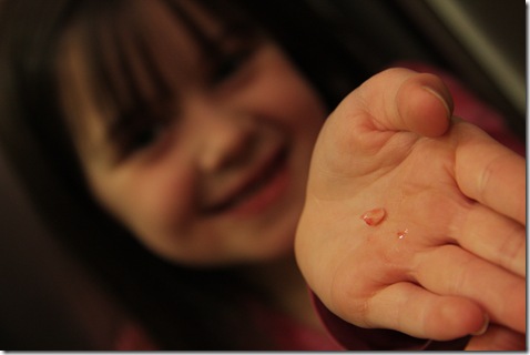 KyliesLostTooth-4