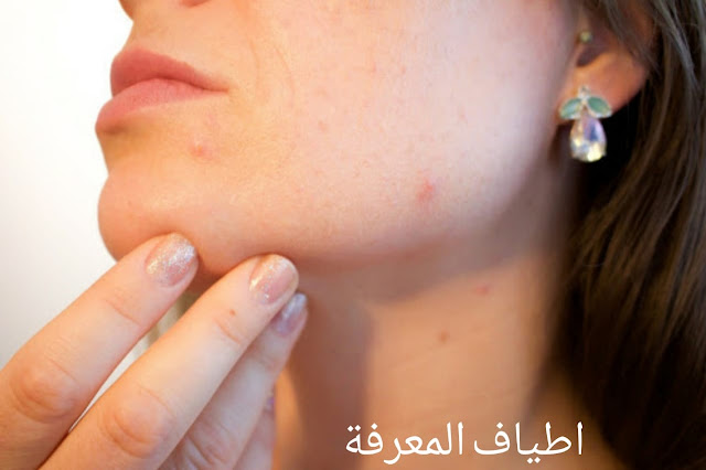 يخفف من أعراض بعض الأمراض الجلدية