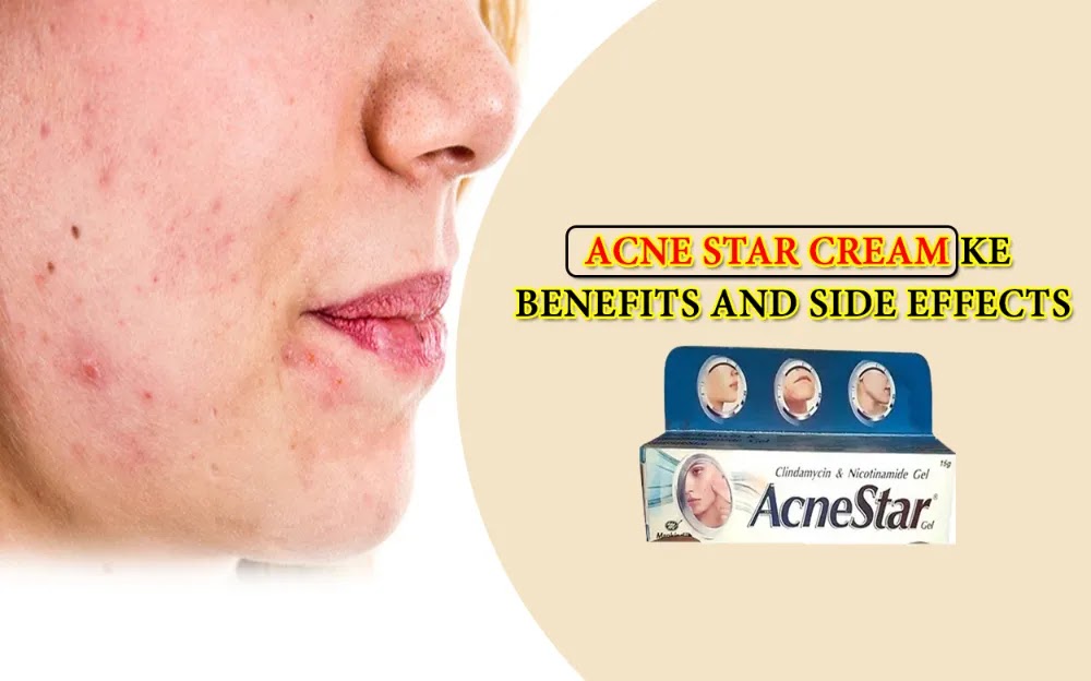 Acne star Cream Ke Benefits and Side Effects