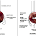 Aerodynamics Of Reverse Swing