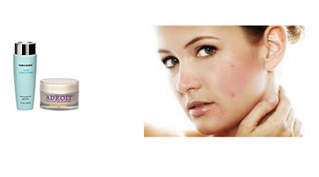 best acne treatment cream that work