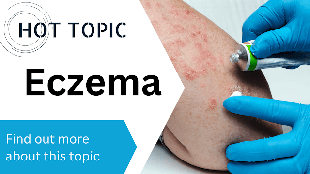 nurse tending to the eczema on a person's arm