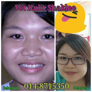 Shaklee kurus shaklee; testimoni shaklee; shaklee labuan; shaklee selamat kah; shaklee berkesan kah; Set kurus shaklee; Agent Shaklee Labuan