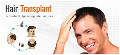 Hair Transplant Surgery offer