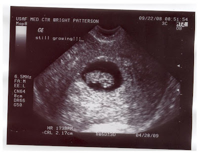 12 5 week ultrasound. sonogram 5 weeks. Ultrasound 8