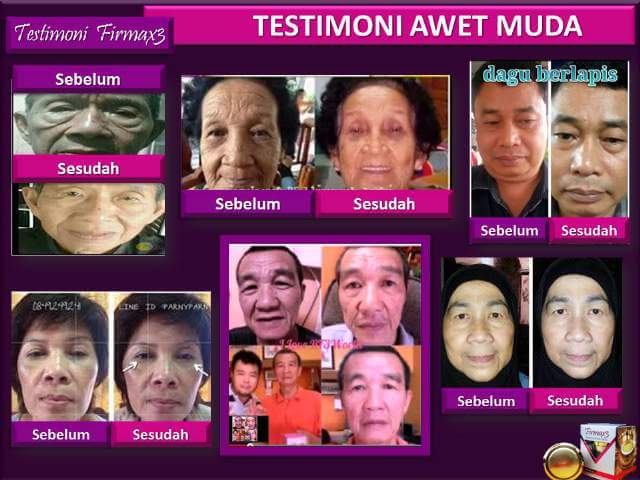 Testimoni Firmax3,Testimoni Firmax3 Cream, Firmax3 firming & lifting cream, firmax3 testimoni, kesaksian firmax3, manfaat firmax3, khasiat firmax3, cara menggunakan firmax3, firmax3 murah, firmax3 untuk lelaki, firmax3 harga, firmax3 cream