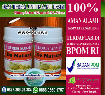 OBAT HERBAL UNTUK SAKIT EKSIM