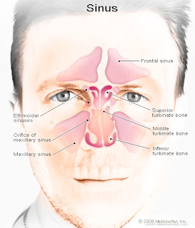 Causes of Sinus