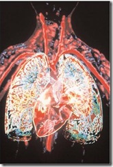 This scan of the cardiovascular system shows the heart and lungs, with major blood vessels radiating from them. Photograph by Howard Sochurek. Corbis.