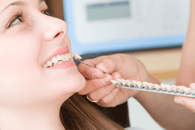 Khắc phục răng bị mẻ đơn giản và tiết kiệm