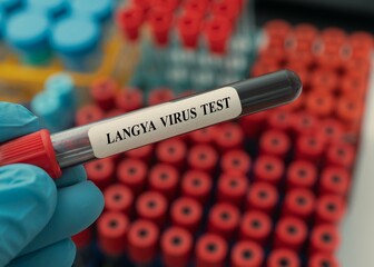 Henipavírus Langya (LayV): uma ameaça emergente exigindo respostas rápidas e focadas