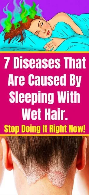 7 Diseases That Are Caused By Sleeping With Wet Hair. Stop Doing It Right Now!