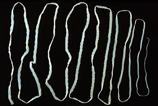 tapeworm