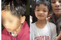 Bocah Ini Dulu Viral Dibuang Ibu dengan Tubuh Penuh Luka, Kini Jadi Anak Kapolres, Ganteng & Bahagia