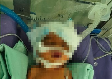 Bayi Laki Ditemukan Masih Dirawat di RSUD Langsa, Kondisi Sudah Stabil