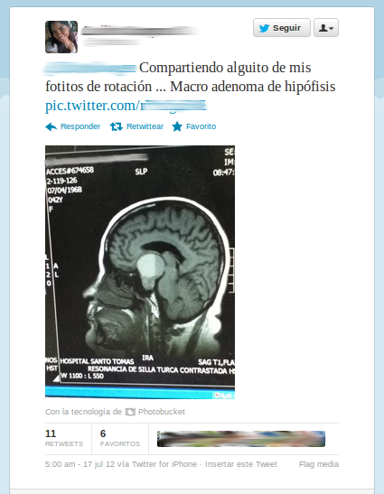 Tweet de la estudiante que compartió la radiografía