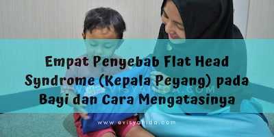 Penyebab Flat Head Syndrome