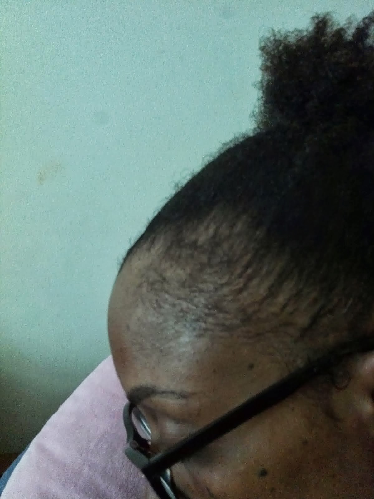 Made-up Hair Style: Thinning Edges
