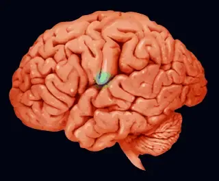 Living with Alzheimer - Some Forgetfulness Is A Normal Part Of Aging
