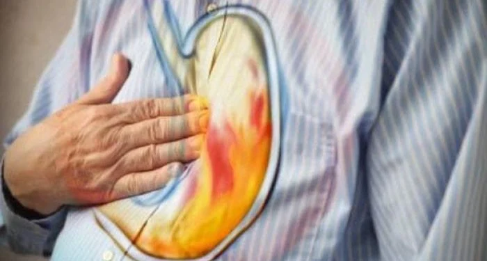 Stop Heartburn Within Seconds Without Medication