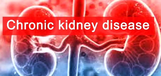 Group laments increase in kidney disease cases in Yobe