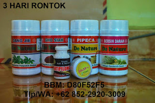 Obat Penghilang Kutil Kemaluan