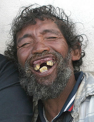 Funny People on This Guy May Have Horrible Teeth  But At Least The Remaining Teeth Fit