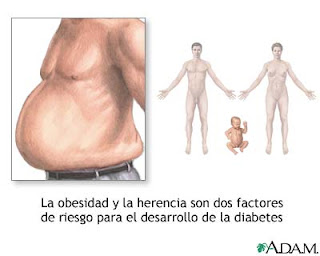 Por que el ser humano se enferma de diabetes tipo 2