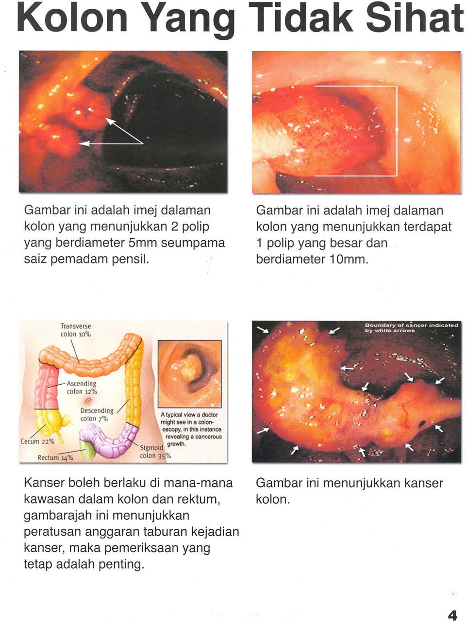 RINTIHAN NURANI: NAJIS TERLONGGOK BERGERAK