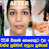 දින 4ක් තුල සුදු වෙන්න පුළුවන් අපුරු ක්‍රමයක්