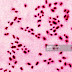 Jual Culture Streptococcus pneumoniae Untuk Riset