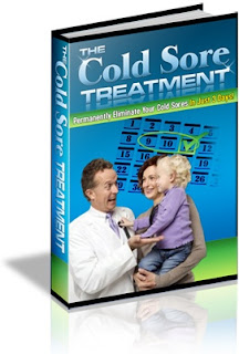 Cold sore treatment - get rid of cold sores permanently