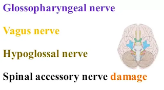 cranial nerve