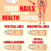 Your Nails Can Be A Good Indicator Of Health Problems