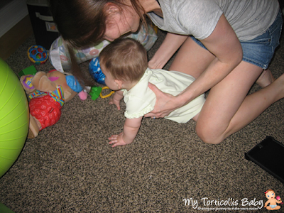 Baby with torticollis doing a supported crawling position with her mom