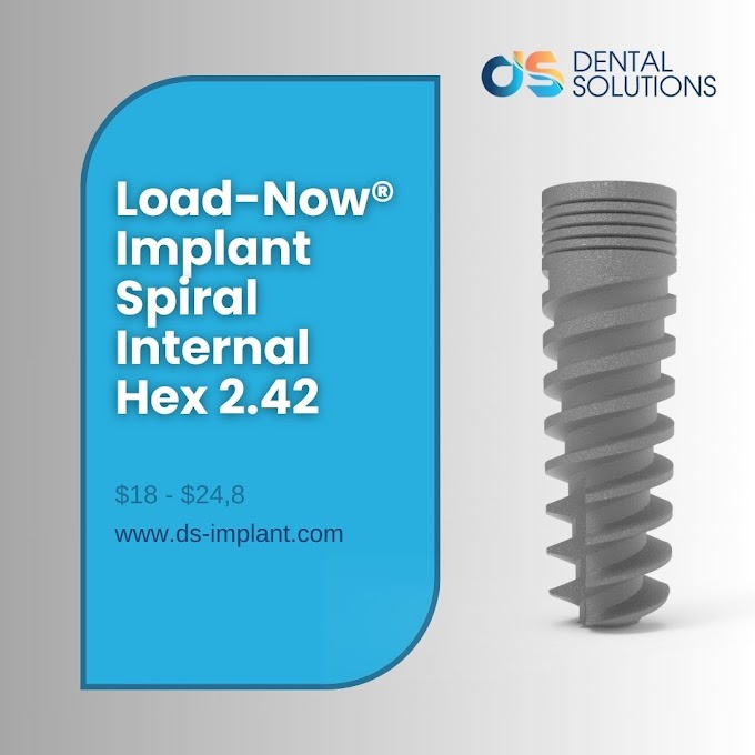 DENTAL SOLUTIONS: Load-Now® Implant Spiral Internal Hex 2.42