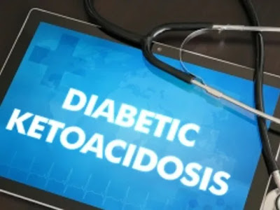 Diabetic Ketoacidosis (DKA)