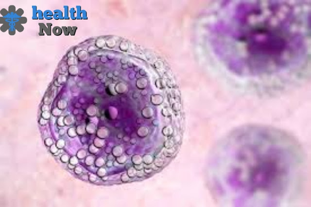 What is small lymphocytic lymphoma-Specific treatments.
