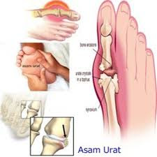 obat asam urat buah buahan