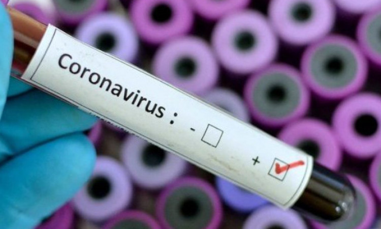 Berapa Lama Virus Corona Bertahan dan Bisa Menular ke Manusia? naviri.org, Naviri Magazine, naviri