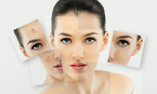 Skin Care Therapies