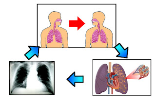 Nursing Diagnosis Knowledge Deficit related to Tuberculosis